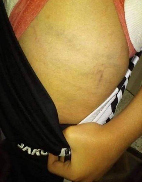 الطب الشرعي يثبت عدم تعرض الطفل لاي تعذيب