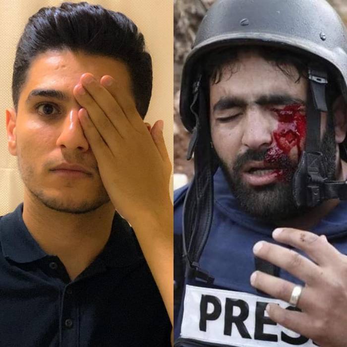 محمد عساف الاحتلال يستهدف العين للتغطية على الجرائم التي يرتكبها بحق الشعب الفلسطيني