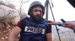 ايعاز لوزير الصحة ومدير الخدمات الطبية بمتابعة الحالة الصحية للمصور العمارنة