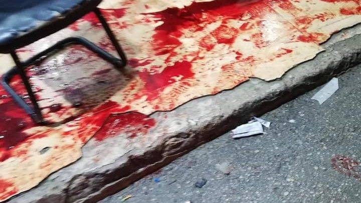 إصابة 4 أشخاص في حادثة إطلاق نار بالرصيفة