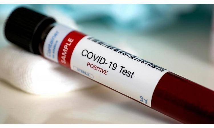 جمع 325 عينة لفحص كورونا في مناطق بلدية الباسلية بمحافظة المفرق