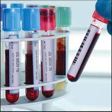 ظهور نتائج فحص عينات مخالطي ممرضة الرمثا وتبين ان نتيجة زوجها جاءت ايجابية