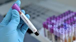 الضفة الغربية : تسجيل 132 إصابة جديدة بفيروس كورونا