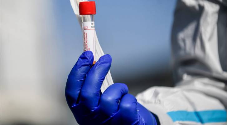 لجنة الأوبئة : انخفاض الإصابات المحلية يمنح أملا بالسيطرة مجددا على الوضع الوبائي