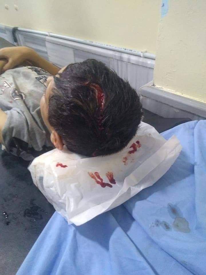 الكلاب الضالة تنهش جسد سيده وثلاثه اطفال في بلدة طيبة بمحافظة إربد