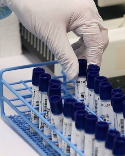 تسجيل اصابه بفايروس كورونا في مدينه مأدبا  لشاب عمره (18)سنه مخالط لمصابين سابقين