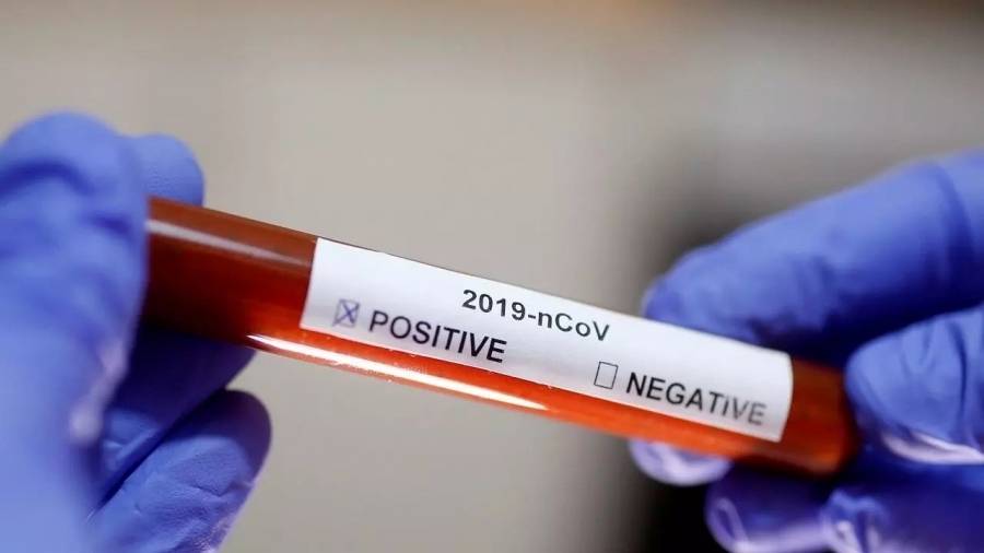 تسجيل (30)اصابة جديدة بفايروس كورونا  في مدينه مأدبا