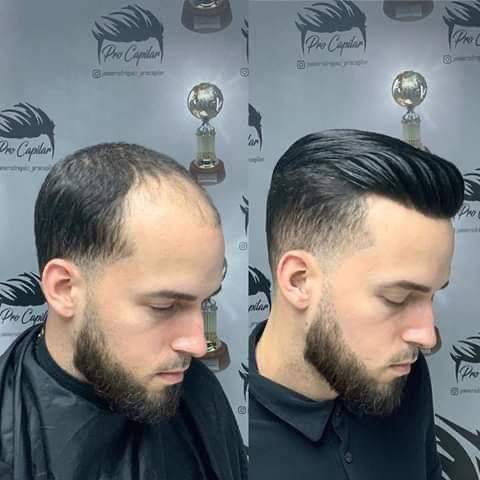 شركة healthy hair club تفتتح فرعها  في الاردن وتقدم افضل انواع البواريك الطبية التجميلية  للجمهور