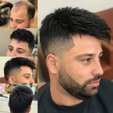 شركة healthy hair club تفتتح فرعها  في الاردن وتقدم افضل انواع البواريك الطبية التجميلية  للجمهور