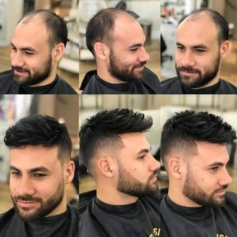 شركة healthy hair club تفتتح فرعها  في الاردن وتقدم افضل انواع البواريك الطبية التجميلية  للجمهور