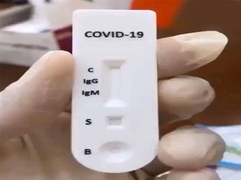 نقيب الصيادلة يطالب بالسماح للصيدليات والمختبرات ببيع جهاز فحص كورونا السريع