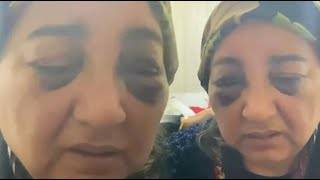 بالفيديو || الشرطة التركية تلقي القبض على زوج يمنع زوجته من الاكل ليومين ويقوم بضربها