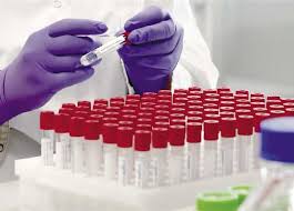 نتائج فحوص 36 مخالطا لمصاب أوميكرون سلبية