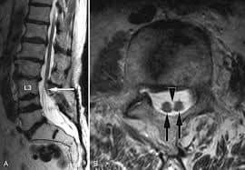 مستشفى الزرقاء الحكومي ولأول مرة يجري عملية جراحية معقدة ونادره لطفل عمره اسبوعين بنجاح ... صور  .