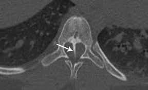 مستشفى الزرقاء الحكومي ولأول مرة يجري عملية جراحية معقدة ونادره لطفل عمره اسبوعين بنجاح ... صور  .