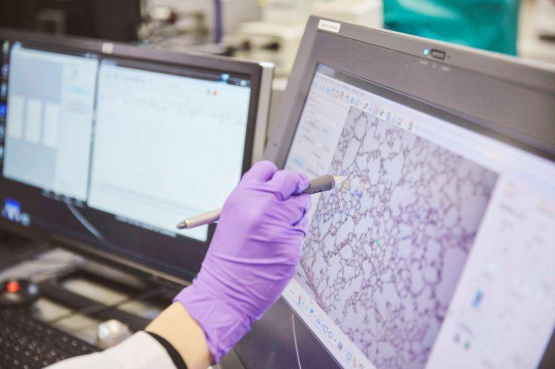 التوجه نحو المنتجات البديلة كخيار للتخلص من الحرق