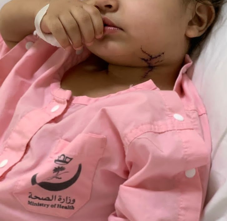 طاولة زجاجية تنقل طفلة سعودية إلى غرفة العمليات
