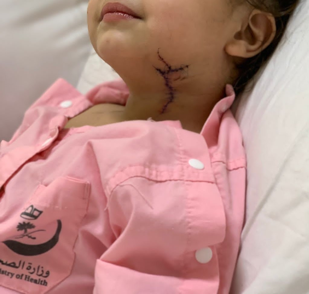 طاولة زجاجية تنقل طفلة سعودية إلى غرفة العمليات