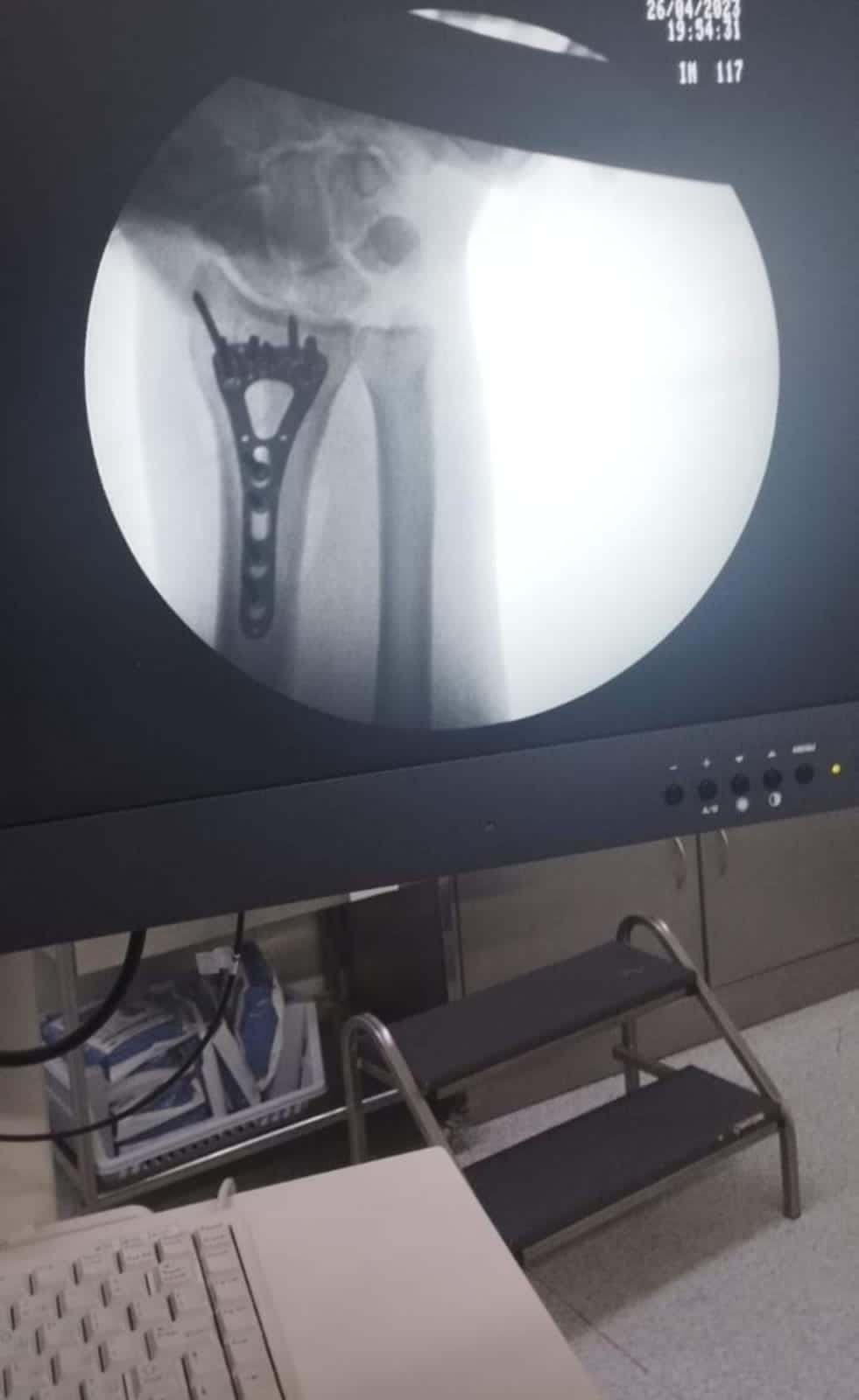 البريزات طبيب العظام البارع  والمتميز