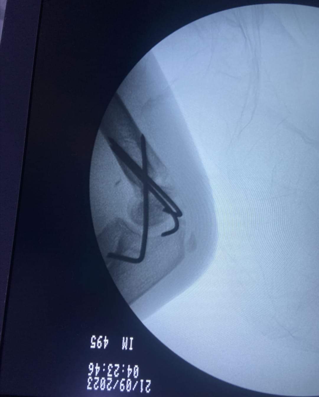 البريزات طبيب العظام البارع  والمتميز