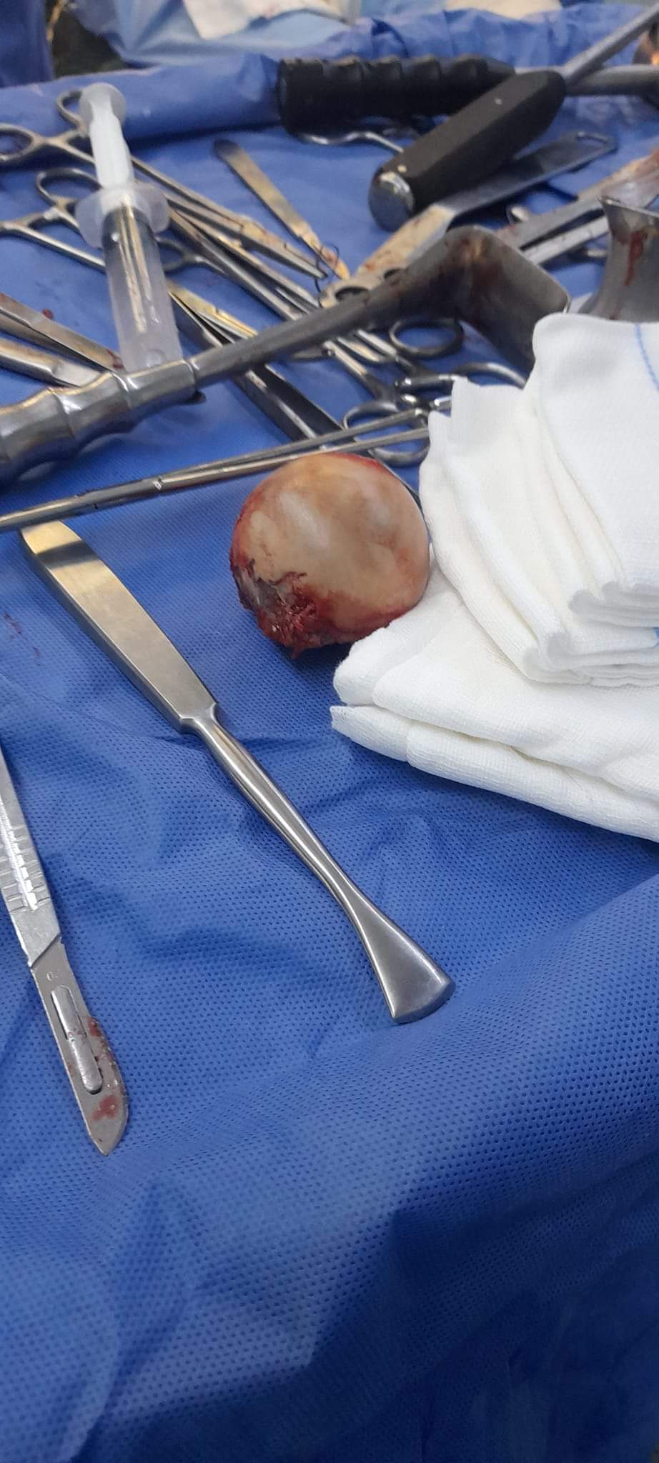 البريزات طبيب العظام البارع  والمتميز